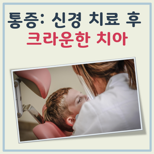 신경치료 후 크라운한 치아 통증 대표 이미지