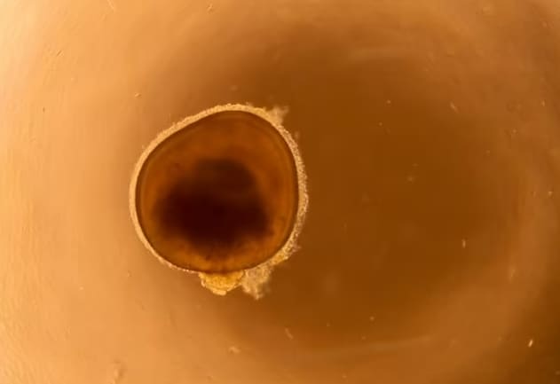 시력 상실자에게 희망...세계 최초 인공 망막 만들어 VIDEO: Second Sight engineered an artificial retina bionic eye
