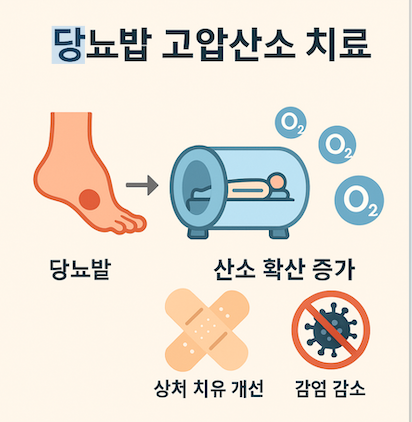 당뇨발 고압산소 치료