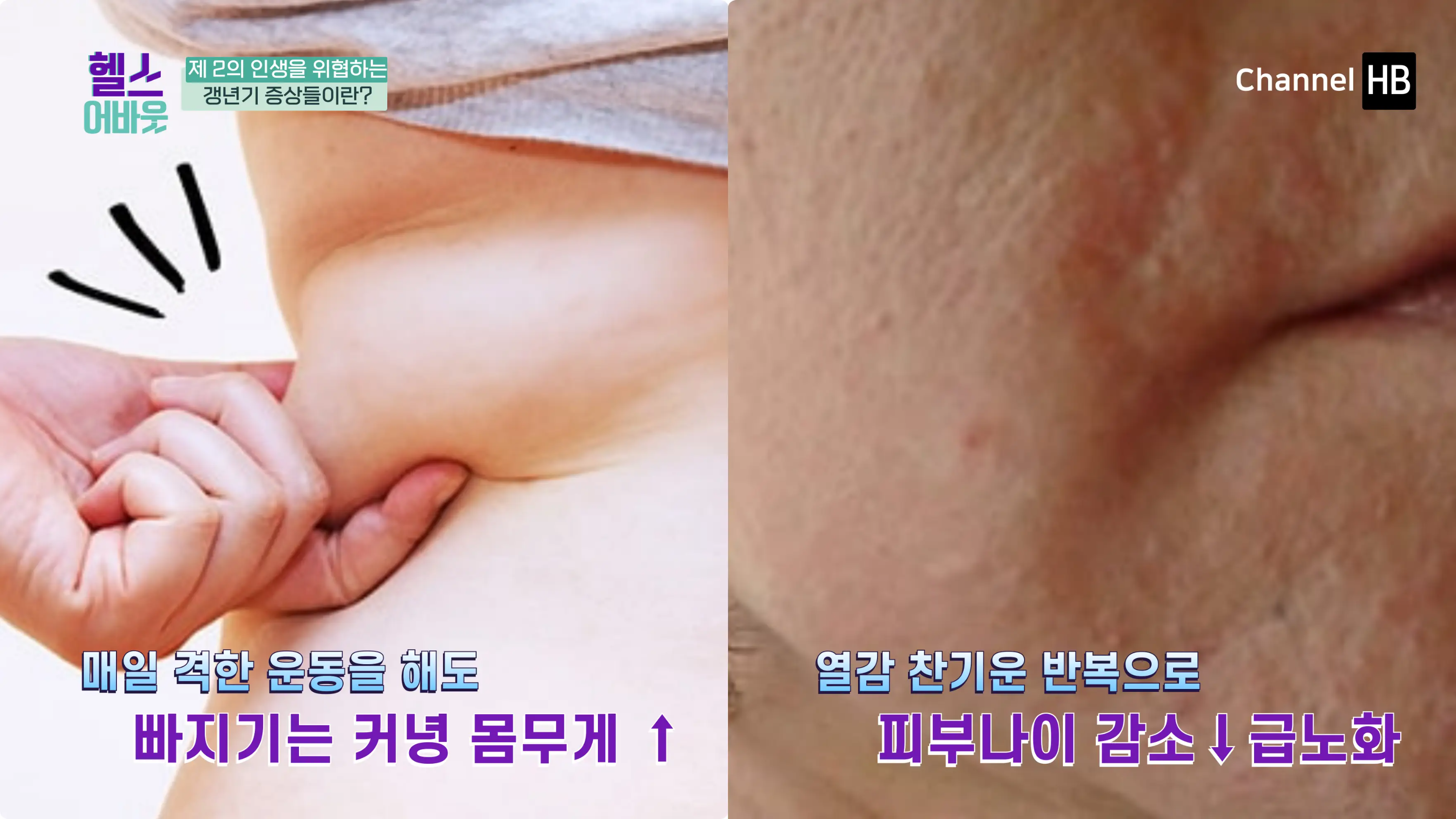 갱년기증상