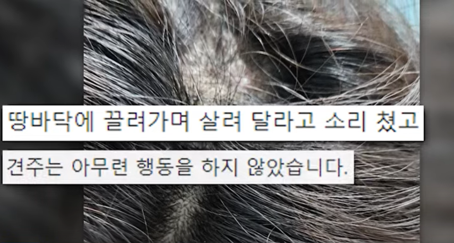 대리기사의 아내 손님 맹견에 머리 물려