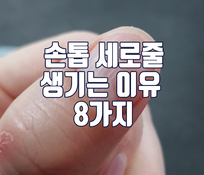 손톱 세로줄 생기는 이유 8가지 정리