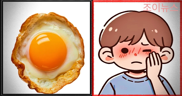 난류 식품알레르기 증상