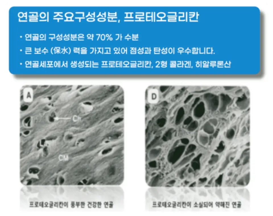프로테오글리칸 효능 가격 추천