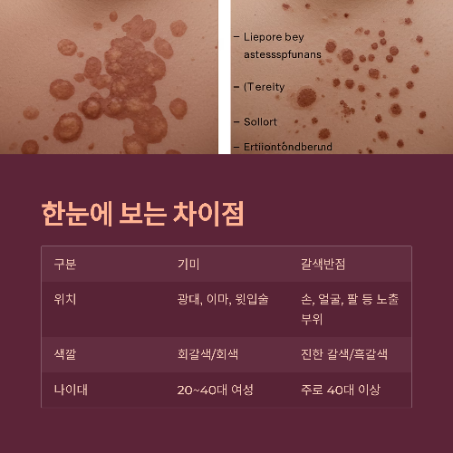 기미와 갈색반점, 똑같은 걸까? 피부 고민 제대로 파헤치기