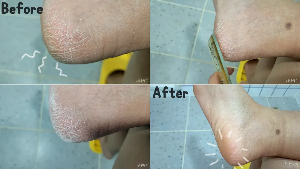 발각질제거-풋파일