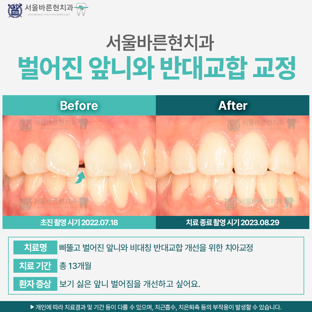 부산교정치과