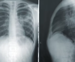 천식 증상 그대로 두면 위험하다 원인 예방법