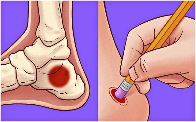 발이 피곤할때 피로 푸는법,발뒤꿈치 지압점,팁줌