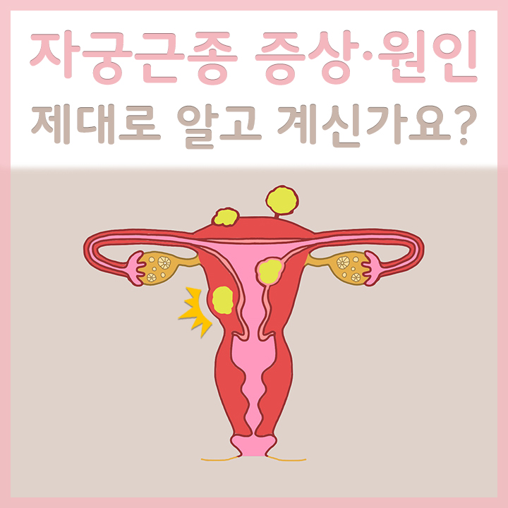 자궁근종이-발생한-자궁