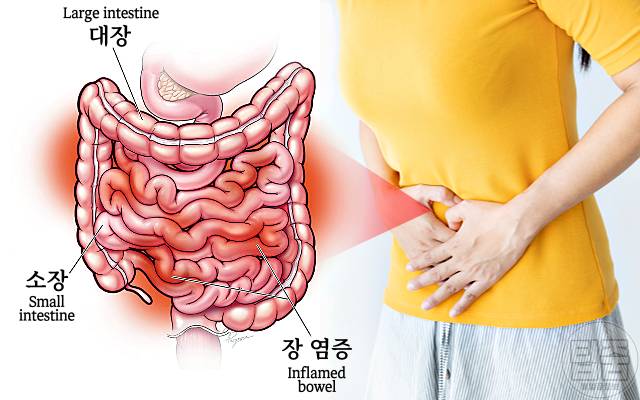 장염에 좋은 음식 장염에 좋은 죽 장염 빨리 낫는 법
