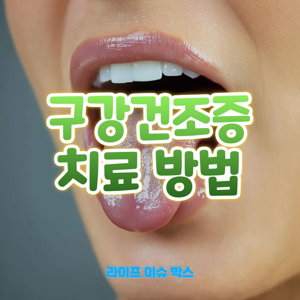 구강건조증 치료 방법
