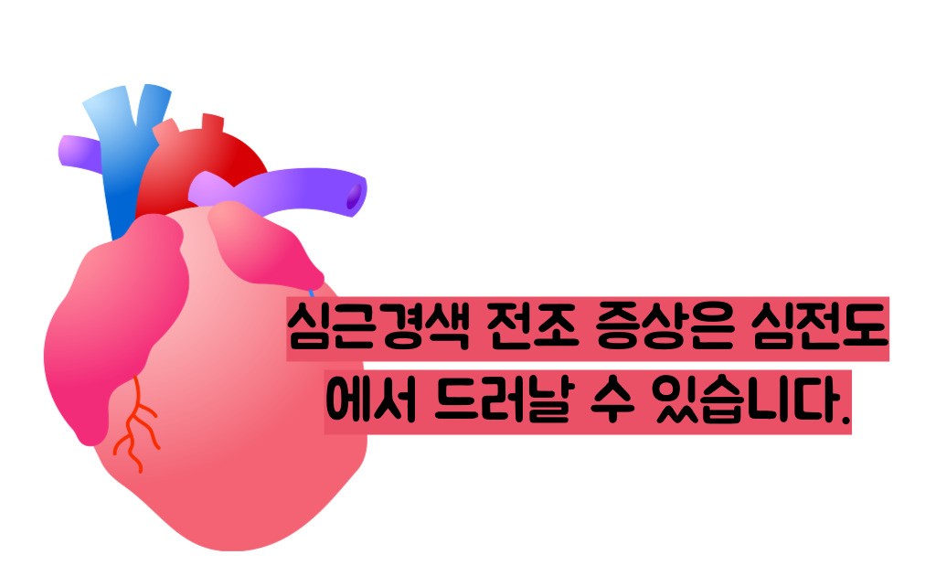 심전도 검사