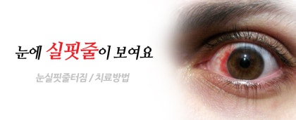 실핏줄 렌즈 사용
