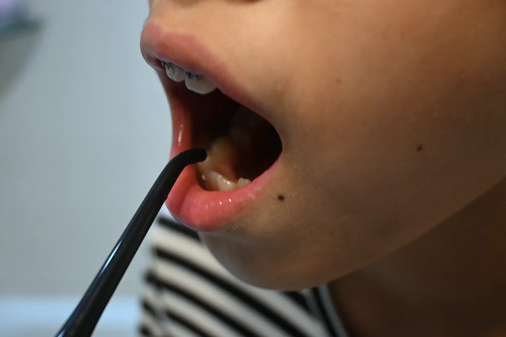 구강세정기 덴탈픽 DP-2300K 사용 후기 사진 13