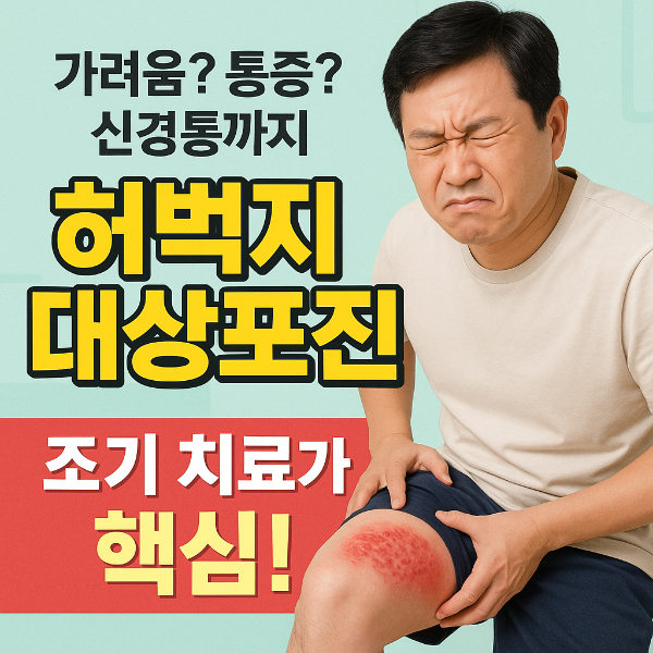 허벅시 대상포진 썸네일 이미지입니다.