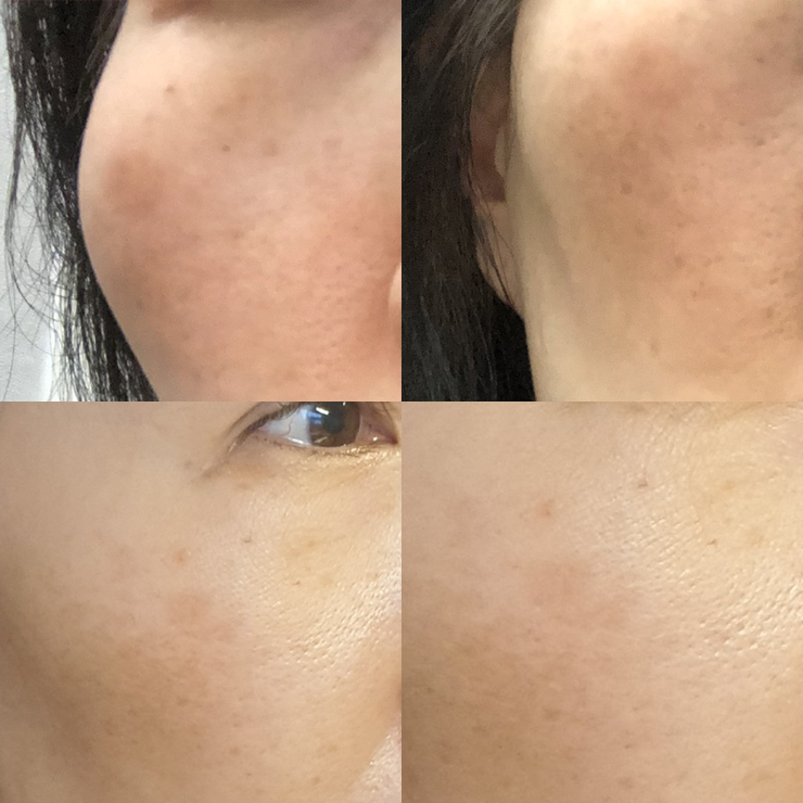 ๊ธฐ๋ฏธ ์์ ๋ ๋ฐฉ๋ฒ