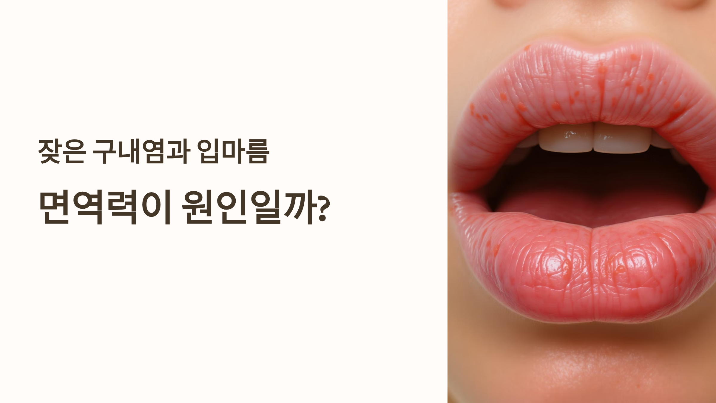 잦은 구내염과 입마름