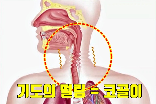 코골이 치료법 기도가 막히는 수면무호흡증, 내장지방 빼는법, 다이어트 건강 팁줌 매일꿀정보