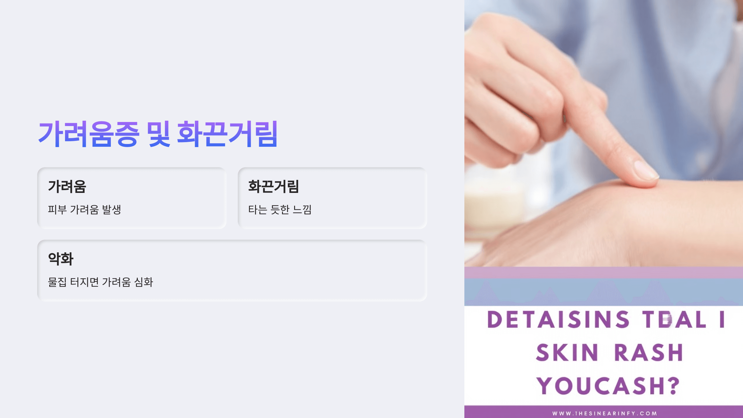 대상포진과 관련된 사진입니다.