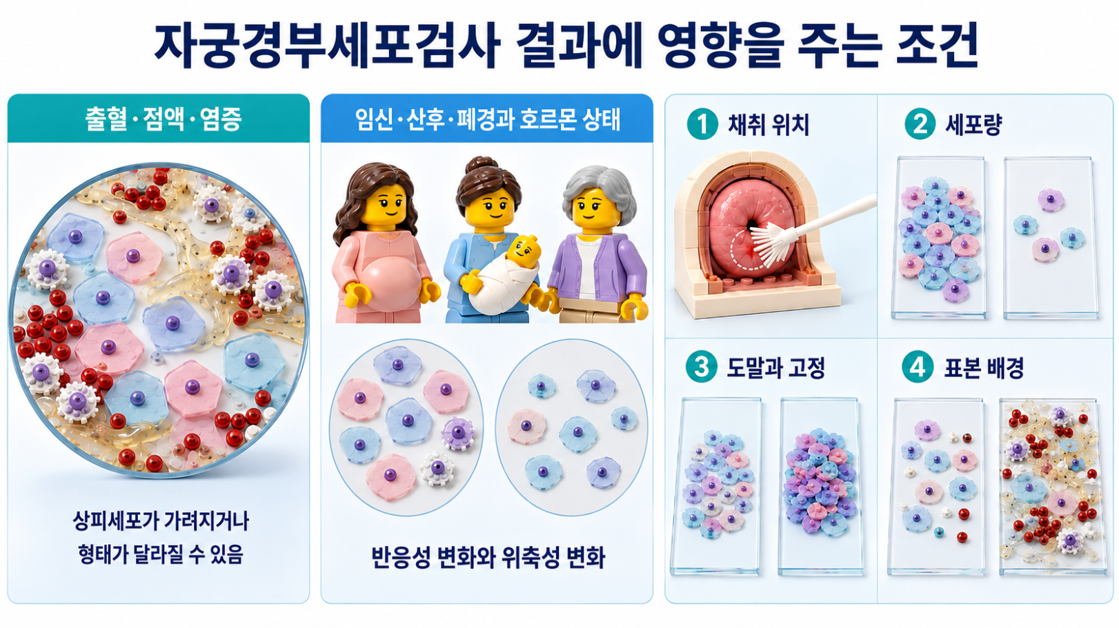 출혈&middot;점액&middot;염증, 임신&middot;산후&middot;폐경, 채취 위치와 세포량 등 자궁경부세포검사 결과 영향 조건을 설명한 이미지
