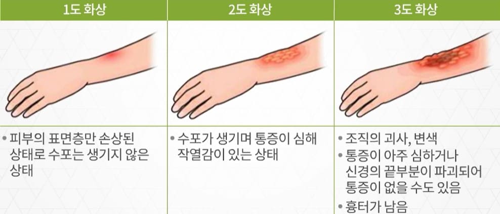 화상의 구분