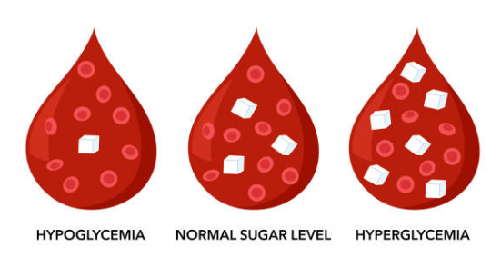 고혈당 쇼크 증상, 쇼크 원인, 낮추는 방법 총정리 (2024ver)