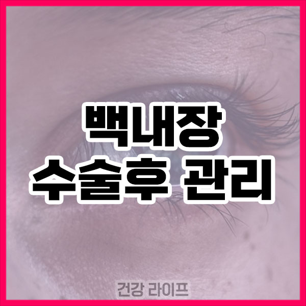 백내장 수술후 관리