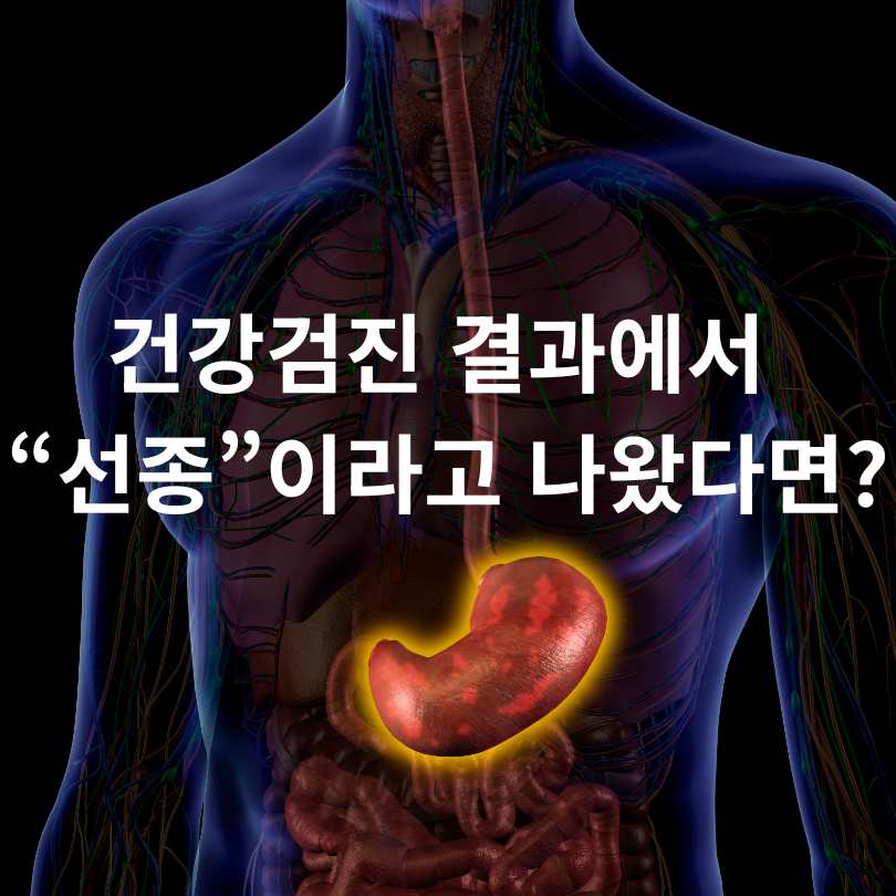 선종과 용종의 차이