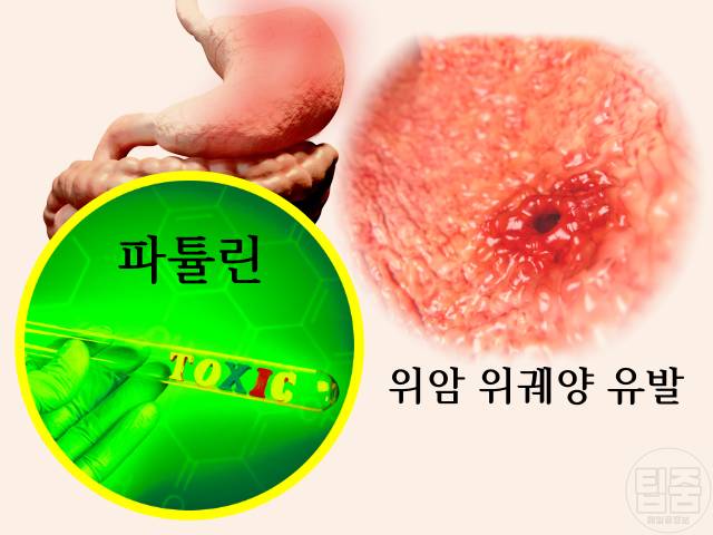 양파 썩은 부분 곰팡이 썩은양파 구별법 위암