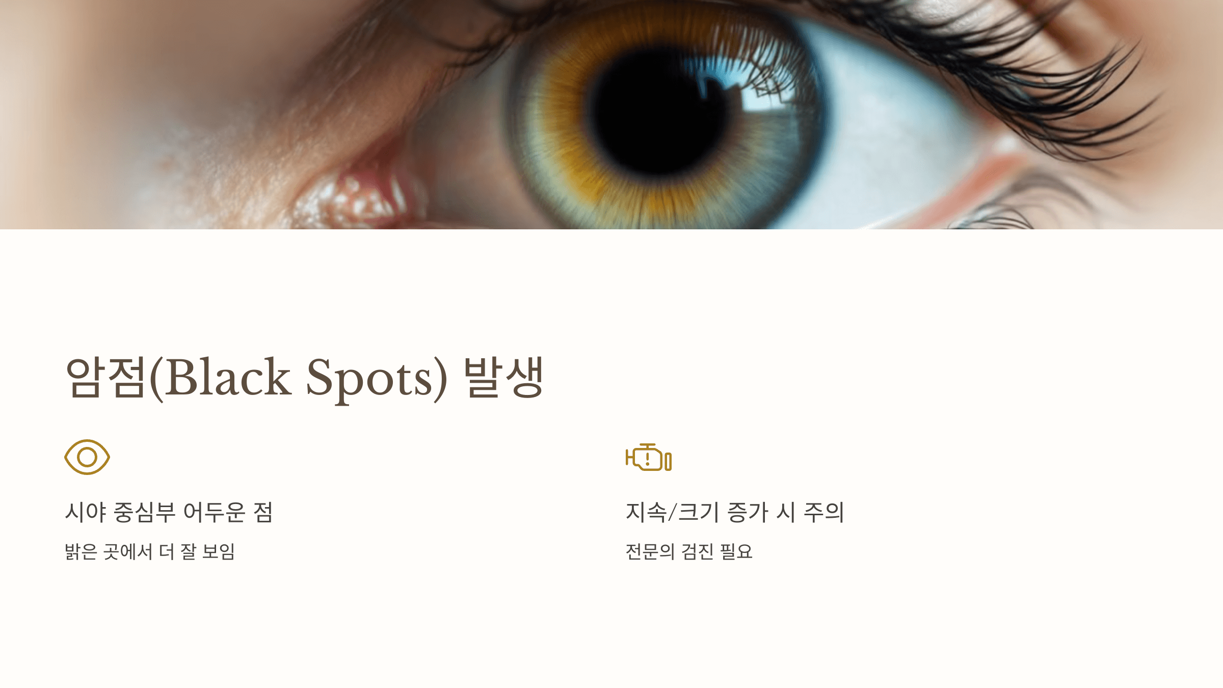 황반변성과 관련된 사진입니다.