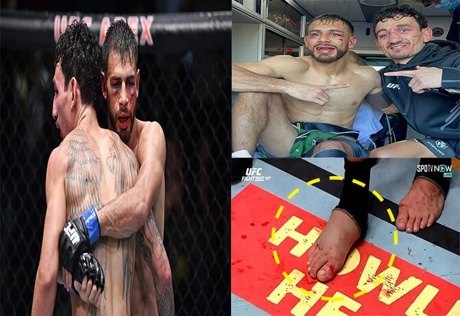 맥스 할로웨이, 야이르 로드리게스 경기 후 충격적인 몸 상태