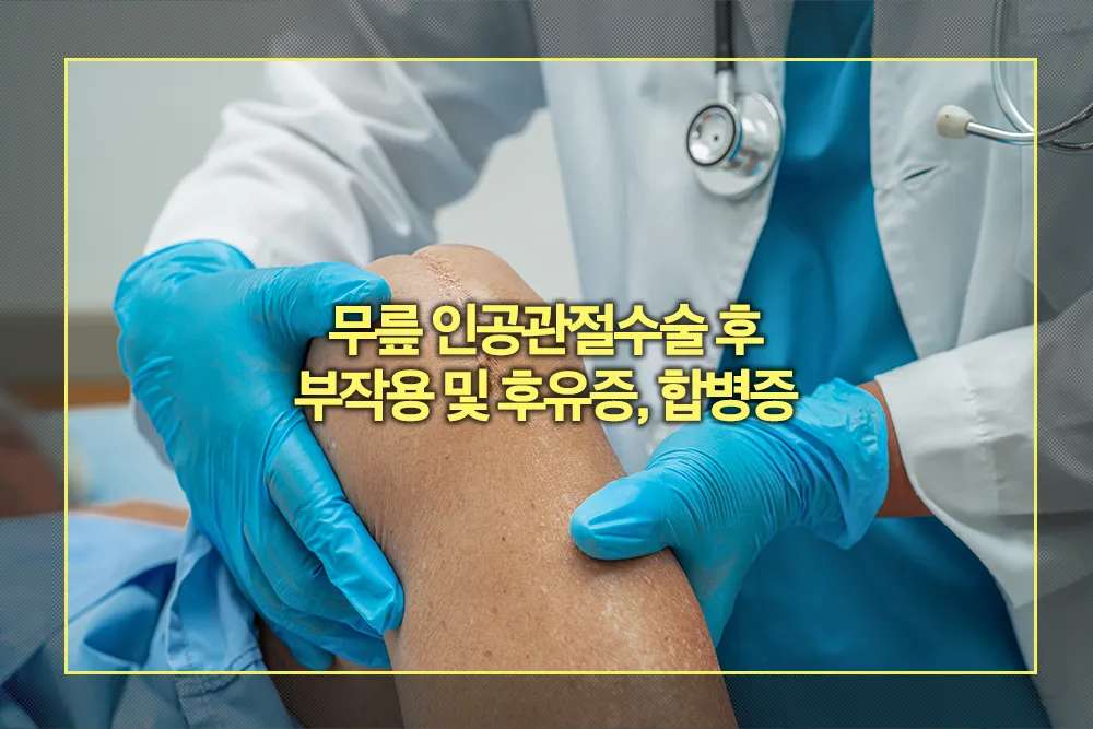 무릎 인공관절수술 부작용 후유증 합병증