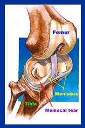 meniscus