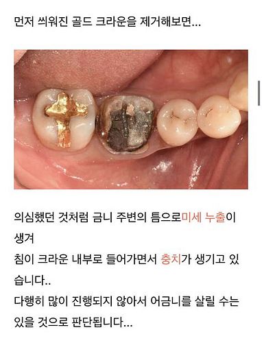 금니가격