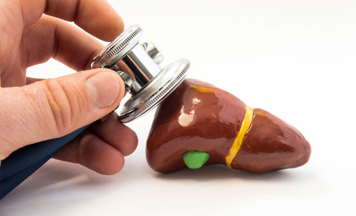 뜻밖의 지방간 증상 원인, 운동부족 근감소증 폐경?