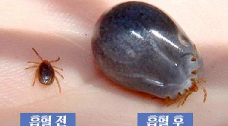 SFTS 중증열성혈소판감소증후군 치료 및 예방 총정리