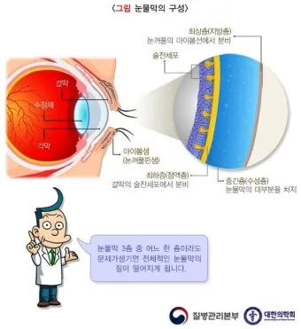 눈물이 자주 나는 이유에 대한 안과정보_19