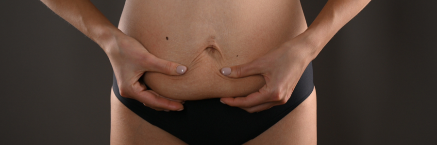 뱃살을-잡고있는-여자
