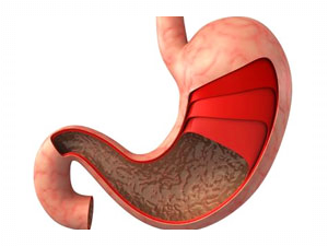 위내시경-금식시간