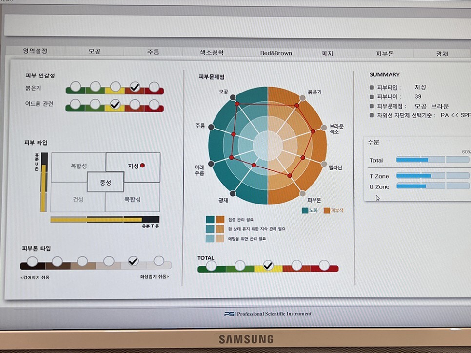레블라이트 토닝 후기