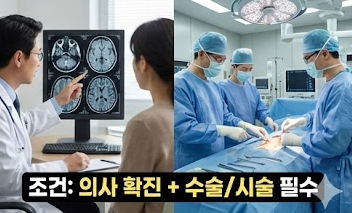 심뇌혈관 산정특례