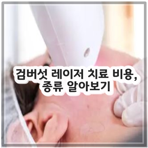 검버섯 레이저 치료 비용, 종류 알아보기
