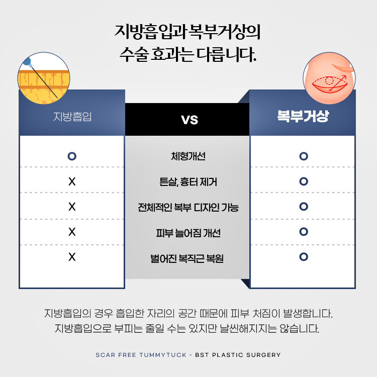 지방흡입의 경우 흡입한 자리의 공간 때문에 피부 처짐이 발생합니다. 지방흡입으로 부피는 줄일 수 있지만 날씬해지지는 않습니다.