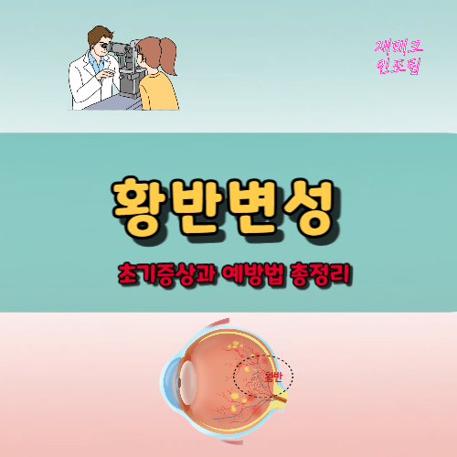 황반변성 초기증상과 예방법 총정리