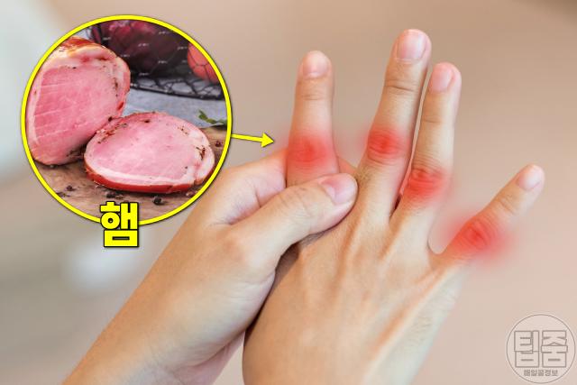 관절염에 나쁜 음식,관절염에 안 좋은 음식,햄 가공육,팁줌