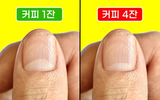 커피 많이 마시면 커피과다복용 부작용 손톱 반달