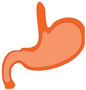 위내시경 금식시간 비용 검사 후 식사 총 정리!