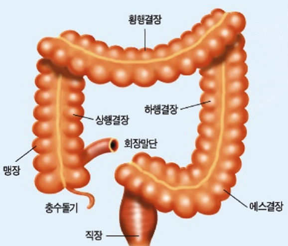 대장암 원인과 예방