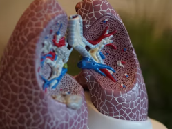 천식 치료법 진단 기준 합병증